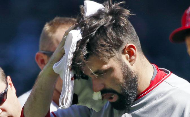 Matt Shoemaker Suffers Skull Fracture on Line Drive